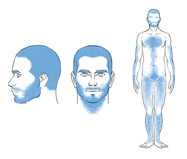 Une version simple de la répartition des poils chez l'homme.